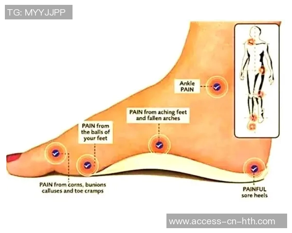 扁平足对足球运动员的影响及应对策略分析与探讨